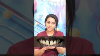 teeth gap  teeth gap filling  teeth gap filling treatment  Composite filling dentalexperience [upl. by Issak]