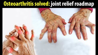 Osteoarthritis A Painful Disease That Severely Affects Joints [upl. by Orlov]