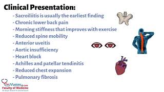 Ankylosing Spondylitis Summarized in 3 Minutes for HCPs Presentation  Diagnosis  Treatment [upl. by Vizza]