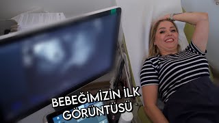 BEBEĞİMİZİN İLK KONTROLÜ  BEBEĞİMİZİ GÖRDÜK [upl. by Lacram709]