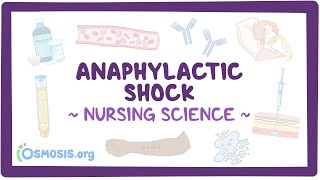 Anaphylactic shock Clinical Nursing Care [upl. by Leandro16]