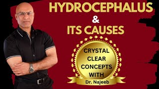 Causes of Hydrocephalus  What is going on in the brain  Dr Najeeb [upl. by Bryce]