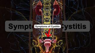 Symptoms of Cystitis cystitis health healthtips shorts [upl. by Sueddaht131]