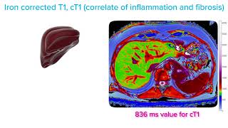 LiverMultiScan See What We Measure [upl. by Four]