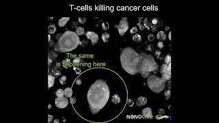 Labelfree Live Cell Imaging Tcells killing colon cancer cells [upl. by Onailime318]