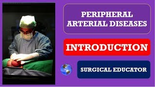 PERIPHERAL ARTERIAL DISEASES  INTRODUCTION Limb Ischemia [upl. by Gracye497]