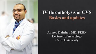 IV thrombolysis in AIS  basics and updates  DrAhmed Dahshan [upl. by Anrim243]