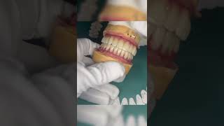 dentist виниры [upl. by Daffi]