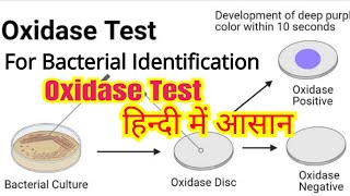 Oxidase test in hindi  Bacterial identification  Microbiology [upl. by Ahsenor]