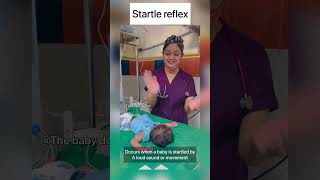 Startle reflex in newborn  moro’s reflex  baby doctor newborn babyvideos shorts cutebaby [upl. by Ainafets]