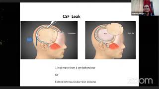 Decompressive Craniectomy  Complications and Avoidance [upl. by Crosley]