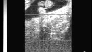 Bovine pregnancy 40 days with EasiScan ultrasoundwmv [upl. by Evreh]