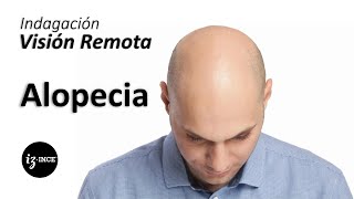 244 Alopecia Indagación Conciencia Efectiva Irazema Nuño [upl. by Giltzow]