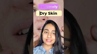 Facewash for Very Dry Skincare shortsfeed shortstrending skincaretelugu [upl. by Nilauqcaj]