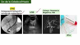 Anatomía del Colédoco [upl. by Crim532]