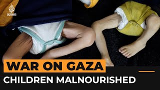 Children are dying of malnutrition in Gaza  Al Jazeera Newsfeed [upl. by Deutsch]