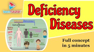 Deficiency Diseases Class 6 Chapter 2 Components of food  CBSE  LearnFatafat [upl. by Eneloc]