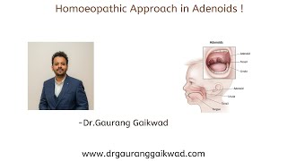 Homoeopathic Approach in Adenoids [upl. by Ruthi228]