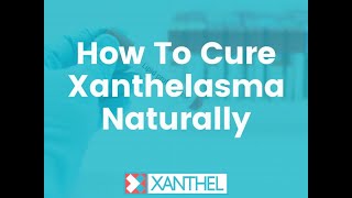 How To Cure Xanthelasma Naturally  Brought To You By XANTHEL ® Easy Xanthelasma Removal [upl. by Curry]