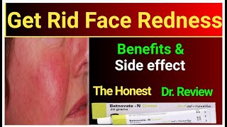 How to use betnovate n cream  benefits and side effects  Dr review betnovate cream [upl. by Doyle]