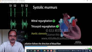 Lecture 13 Hearts Sounds Phonocardiography [upl. by Simmons853]