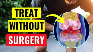 The Best Knee Arthritis Treatments Without Surgery [upl. by Alliuqaj940]