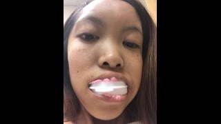 ROOT CANAL FRONT TOOTH CROWN AND FILLING EXPERIENCE PT1 [upl. by Ailehs110]