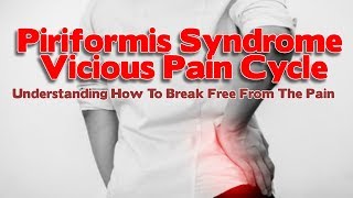 Piriformis Syndrome Causes amp How Pain Increases Via This Vicious Cycle [upl. by Dola]