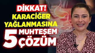 DİKKAT Karaciğer Yağlanmasına Karşı 5 Muhteşem Çözüm Yolu Karaciğer Yağlanması Nedenleri ve Çözümü [upl. by Hyde]