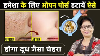 रोम छिद्र Open Pores छीन रहे हैं चेहरे का निखार तो उपनाये 3 आसान उपाय  DIY Face ScrubTonerPack [upl. by Nauqal]