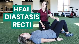 Exercises to Fix Your Diastasis Recti  Physical Therapy [upl. by Ayotac]