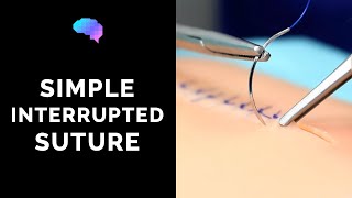 Simple interrupted suture wound suturing  OSCE Guide  UKMLA  CPSA [upl. by Eecart]