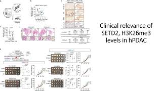 Clinical relevance of SETD2 H2K36me3 levels in hPDAC human pancreatic adenocarcinoma Code 736 [upl. by Onafets553]