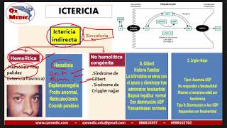 Qx gastroenterologia  SINDROME ICTERICO [upl. by Juta]