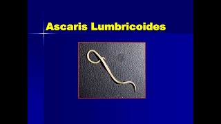 Ascaris lumbricoid in Amharic [upl. by Asor]