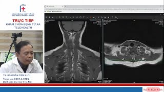 Case Yếu tay trái theo dõi Hội chứng lối thoát ngực [upl. by Domenic]