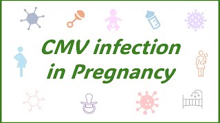 Congenital CMV infection [upl. by Fiorenza]