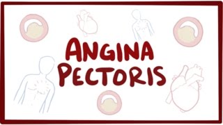 Angina pectoris stable unstable prinzmetal vasospastic  symptoms amp pathology [upl. by Francesca731]