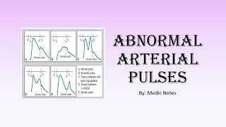 Types of arterial pulses  anacrotic bigeminal dicrotic pulsus alternans pulsus parvus et tardus [upl. by Boonie728]