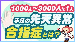 【意外と多い】手足の先天性異常の合指症を医師監修で詳しく解説 [upl. by Gypsie496]