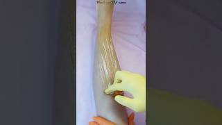 Wax hair removal with honey on the leg elenazaitsevadepilprof [upl. by Feerahs]