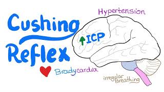 Cushing Reflex  Cushing Triad  Intracranial Hypertension  Emergency Medicine and EMS EMT [upl. by Namruht]