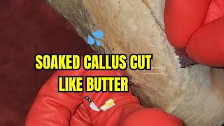 SOAKED CALLUS CUT LIKE BUTTER [upl. by Bumgardner]