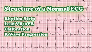 Structure of a Normal ECG  Rhythm Strip  Calibration  Normal Vs Poor R Wave Progression [upl. by Harbed]