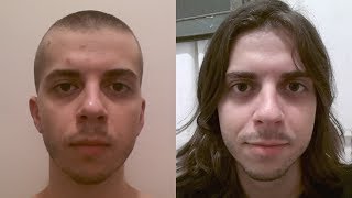 2 YEARS OF HAIR GROWTH DAILY SELFIE TIMELAPSE [upl. by Ecinereb]