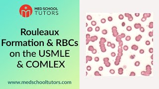 Rouleaux Formation amp RBCs on the USMLE [upl. by Gates]