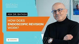 Endoscopic Revision Dr Batash Explains What It Is amp Illustrates How It Works [upl. by Htiffirg]