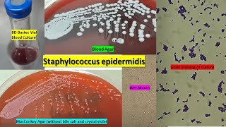 Staphylococcus epidermidis growth on BD Bactec Vial Blood agar Wet mount and Gram Staining [upl. by Nrol]