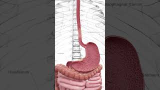 🔬 Understanding Esophageal Cancer Early Detection Is Key 🔬 anatomy [upl. by Gun]