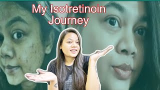 ISOTRETINOIN TABLETS Update after 1 Year  Does isotretinoin remove acne permanently [upl. by Eiduam4]